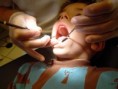 /album/childrens-dentist/optional-5-jpg/